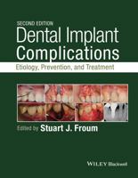 Dental Implant Complications: Etiology, Prevention, and Treatment 1118976452 Book Cover