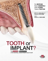 Tooth or Implant? The recovery or replacement of the severely compromised natural tooth 1957260521 Book Cover