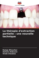 La thérapie d'extraction partielle: une nouvelle technique (French Edition) 6207972449 Book Cover