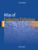 Atlas of Endocrine Pathology 1493904426 Book Cover