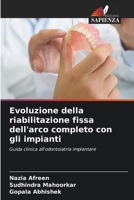 Evoluzione della riabilitazione fissa dell'arco completo con gli impianti 6206615464 Book Cover