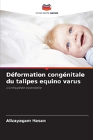 Déformation congénitale du talipes equino varus: L'orthopédie essentielle 6205606836 Book Cover