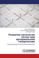 Razvitie patologii pochek pri arterial'noy gipertenzii: molekulyarnye i kletochnye mekhanizmy 3659291617 Book Cover