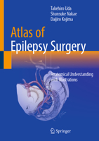 Atlas of Epilepsy Surgery: Anatomical Understanding with Illustrations 9819201756 Book Cover