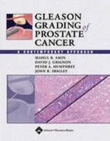 Gleason Grading of Prostate Cancer: A Contemporary Approach 078174279X Book Cover