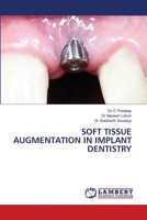 Soft Tissue Augmentation in Implant Dentistry 6205510421 Book Cover