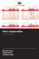 Péri-implantite (French Edition) 6209330339 Book Cover