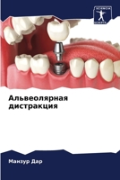 Альвеолярная дистракци&# 6205651149 Book Cover