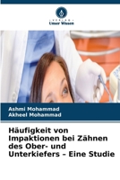 Häufigkeit von Impaktionen bei Zähnen des Ober- und Unterkiefers - Eine Studie (German Edition) 6630294149 Book Cover