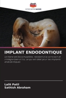 Implant Endodontique (French Edition) 6209913830 Book Cover