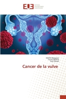 Vulvakrebs 6206702235 Book Cover