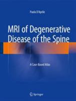 MRI of Degenerative Disease of the Spine: A Case-Based Atlas 3319094467 Book Cover