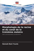 Morphologie de la racine et du canal de la troisième molaire: Dans une population jordanienne 6202858621 Book Cover