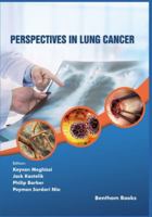 Perspectives in Lung Cancer 981145955X Book Cover