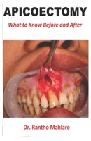 Apicoectomy: What to Know Before and After B08KYWB5Q1 Book Cover