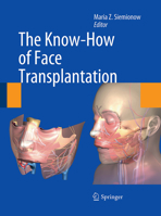 The Know-How of Face Transplantation 0857292528 Book Cover