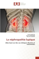 La néphropathie lupique 6203424978 Book Cover