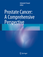 Prostate Cancer: A Comprehensive Perspective 1447142608 Book Cover