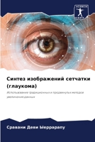 Синтез изображений сетчатки (глаукома): Использование традиционных и продвинутых методов увеличения данных 6206301400 Book Cover