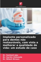 Implante personalizado para dentes não restauráveis, com vista a melhorar a qualidade de vida: um estudo de caso (Portuguese Edition) 6630444205 Book Cover
