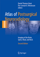 Atlas of Postsurgical Neuroradiology: Imaging of the Brain, Spine, Head, and Neck 3642158277 Book Cover