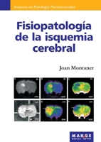 Fisiopatología de la isquemia cerebral (Spanish Edition) 8486684838 Book Cover