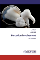 Furcation involvement: An overview 620253186X Book Cover