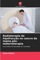 Radioterapia de hipofracção no cancro da mama pós-máterioterapia 6205752778 Book Cover