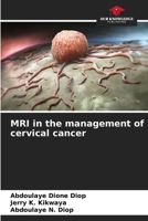MRI in the management of cervical cancer 620955699X Book Cover