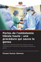 Perles de l'ostéotomie tibiale haute : une procédure qui sauve le genou: Ostéotomie tibiale haute avec fixateur externe Uniplaner pour l'arthrose unicompartimentale du genou (French Edition) 6208810671 Book Cover