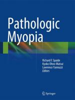 Pathologic Myopia 1461483379 Book Cover
