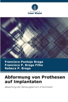 Abformung von Prothesen auf Implantaten (German Edition) 6207745965 Book Cover