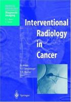 Interventional Radiology in Cancer 3540418733 Book Cover