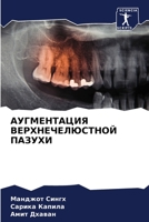 АУГМЕНТАЦИЯ ВЕРХНЕЧЕЛЮСТНОЙ ПАЗУХИ 6206228487 Book Cover