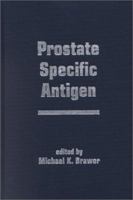 Prostate Specific Antigen (Fast Facts) 0824705556 Book Cover