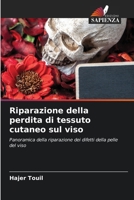 Riparazione della perdita di tessuto cutaneo sul viso (Italian Edition) 6208095778 Book Cover