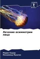 Лечение асимметрии лица 6205863731 Book Cover