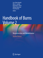 Handbook of Burns Volume 2: Reconstruction and Rehabilitation 3030345106 Book Cover