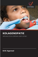 Kolagenopatie 6209109241 Book Cover
