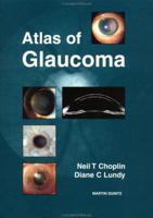 Atlas of Glaucoma 1853173754 Book Cover