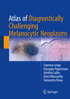 Atlas of Diagnostically Challenging Melanocytic Neoplasms 3319486519 Book Cover