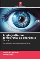 Angiografia por tomografia de coerência ótica (Portuguese Edition) 6208276047 Book Cover