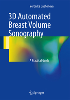 3D Automated Breast Volume Sonography: A Practical Guide 3319419706 Book Cover