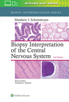 Biopsy Interpretation of the Central Nervous System 1496382633 Book Cover