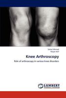 Knee Arthroscopy: Role of arthroscopy in various knee disorders 3659152617 Book Cover