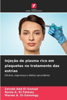 Injeção de plasma rico em plaquetas no tratamento das estrias (Portuguese Edition) 620995023X Book Cover