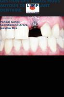Gestion Des Tissus MOUS Autour de l'Implant Dentaire (French Edition) 6208466067 Book Cover