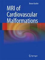MRI of Cardiovascular Malformations 354030701X Book Cover
