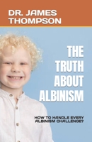 The Truth about Albinism: How to Handle Every Albinism Challenge? B0BTRPH8C7 Book Cover