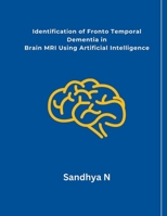 Identification of Fronto Temporal Dementia in Brain MRI Using Artificial Intelligence B0CMMX9CPL Book Cover